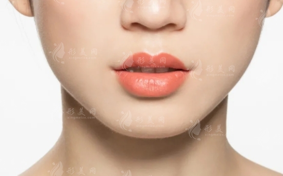 笑唇整形手術費用解析：是否高昂及具體價格探討