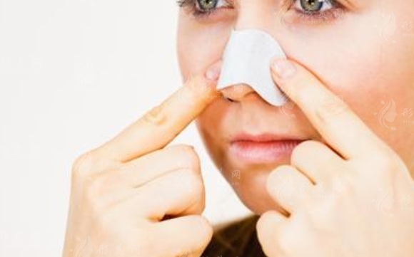 預防鼻翼縮小手術留下疤痕的全方位指南 預防鼻翼縮小手術留下疤痕的全方位指南