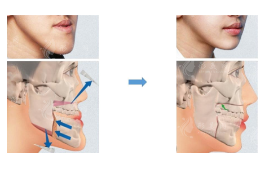 上海第九人民醫(yī)院正頜收費(fèi)價(jià)格：醫(yī)生名單、特色項(xiàng)目與案例分享