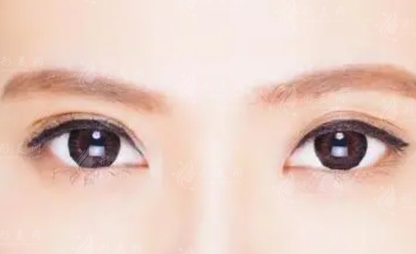 上瞼下垂的治療：方法與可能性