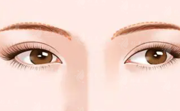 上海美萊整形雙眼皮技術(shù)怎么樣？醫(yī)生信息、擅長(zhǎng)項(xiàng)目、附收費(fèi)表