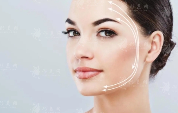 埋線提升：原理與效果解析