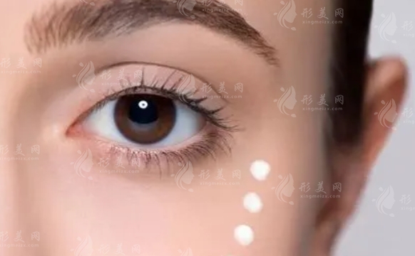 埋線雙眼皮手術(shù)：了解其后遺癥與風(fēng)險