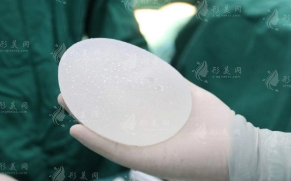 探討隆胸假體不合格滲漏的修復(fù)可能性