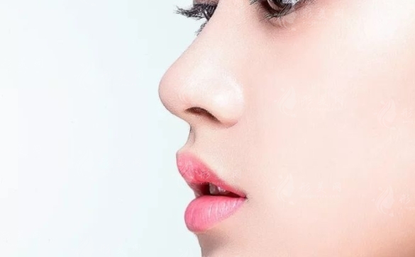 假體隆鼻腫脹消退的時(shí)間探討