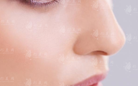 肋軟骨隆鼻VS假體隆鼻：哪個(gè)更適合你？