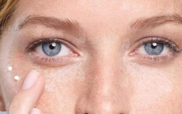 外切眼袋手術(shù)恢復(fù)自然的時間探討 外切眼袋手術(shù)恢復(fù)自然的時間探討