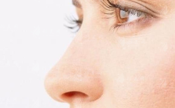 縮小鼻子的方法及其適用人群