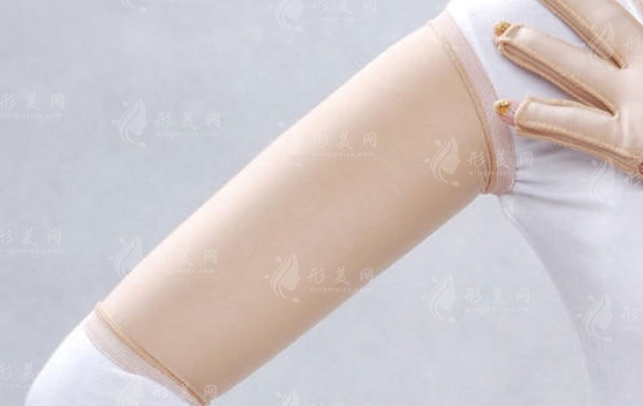 手臂吸脂后腫脹消退的時間探討 手臂吸脂后腫脹消退的時間探討