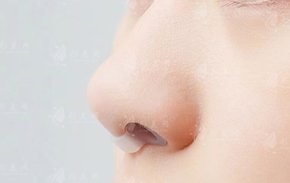 矯正歪鼻：副作用與費(fèi)用解析