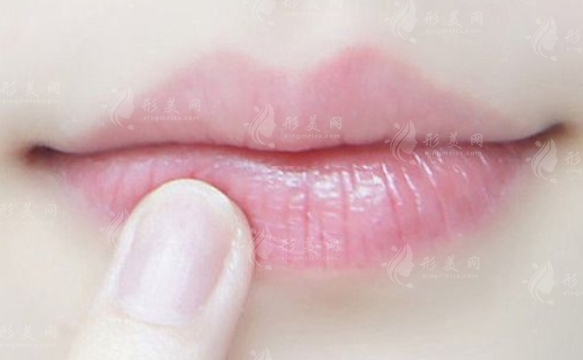 嘴角上揚(yáng)整形手術(shù)：微笑背后的原理與費(fèi)用考量