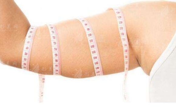 手臂吸脂手術(shù)的風(fēng)險與術(shù)后腫脹管理 手臂吸脂手術(shù)的風(fēng)險與術(shù)后腫脹管理