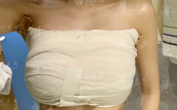 開眼角手術(shù):好處與壞處的全面解析 開眼角手術(shù):好處與壞處的全面解析