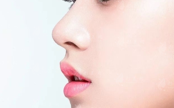 假體隆鼻的材料種類與優(yōu)點(diǎn)