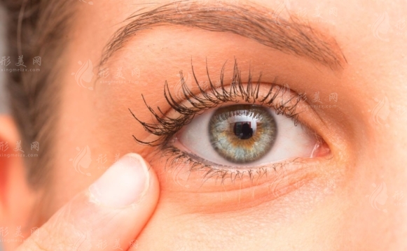 眼部除皺:定義與多種方法詳解 眼部除皺:定義與多種方法詳解