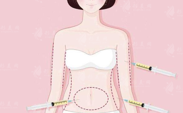 西京醫(yī)院整形吸脂優(yōu)勢介紹，實(shí)力醫(yī)生信息、案例、收費(fèi)表更新