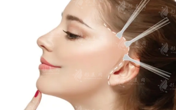 拉皮手術(shù)：什么年齡階段做更合適？