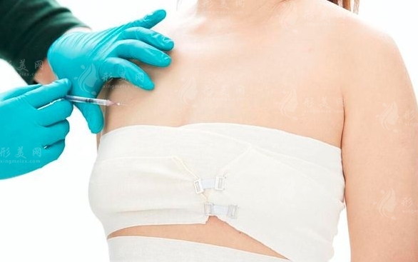 自體脂肪隆胸是否會留疤及術(shù)后注意事項