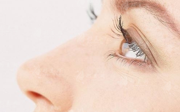 鼻翼縮小手術(shù)后何時(shí)拆線及拆線后的注意事項(xiàng)