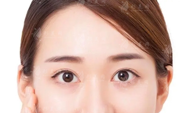 膨體填充額頭：自然與效果的完美平衡