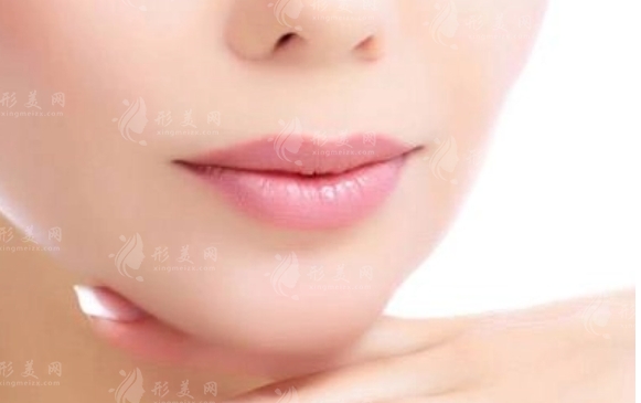 墊下巴后正常笑與完全恢復的時間探討