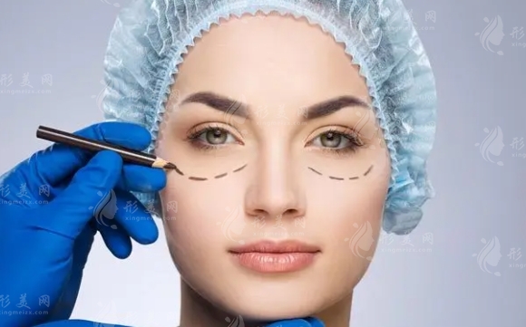 面部吸脂:全面了解你的美麗之旅 面部吸脂:全面了解你的美麗之旅