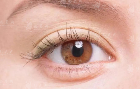 20歲雙眼皮下垂的解決之道及優(yōu)質(zhì)醫(yī)院推薦 20歲雙眼皮下垂的解決之道及優(yōu)質(zhì)醫(yī)院推薦