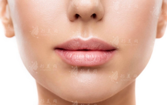 自體脂肪豐唇的優(yōu)勢及注意事項