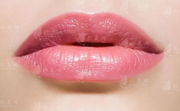 唇外翻矯正術(shù)前的準(zhǔn)備工作及唇外翻畸形原因解析 唇外翻矯正術(shù)前的準(zhǔn)備工作及唇外翻畸形原因解析