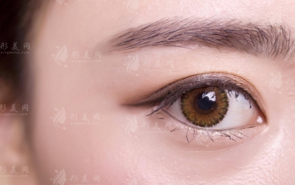 開眼角多久可以戴隱形眼鏡？術(shù)后如何護(hù)理好？