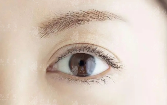 眼皮抽脂會不會留下疤痕？及術(shù)后護理指南