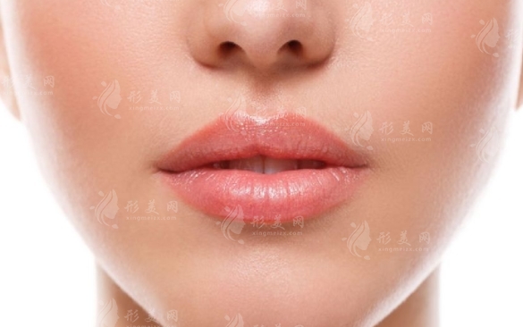厚嘴唇變薄術(shù)：適應(yīng)人群與技術(shù)優(yōu)勢