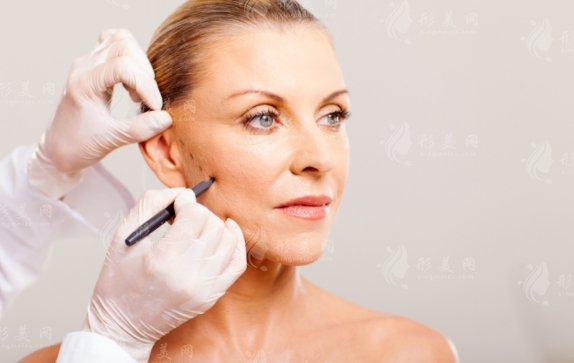 什么年齡適合電波拉皮？及其副作用分析