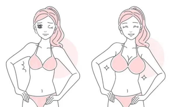 上海美萊整形豐胸怎么樣？實力派醫(yī)生、項目介紹、收費表