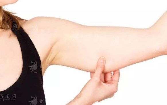 手臂抽脂手術(shù)后多久可以完全恢復(fù)？