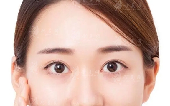 額部填充的材料及其價格：上班族能否負擔得起？