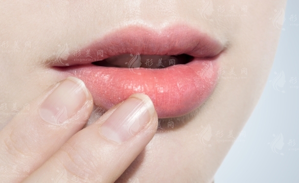 嘴角上揚(yáng)手術(shù)疤痕多久可以恢復(fù)好？