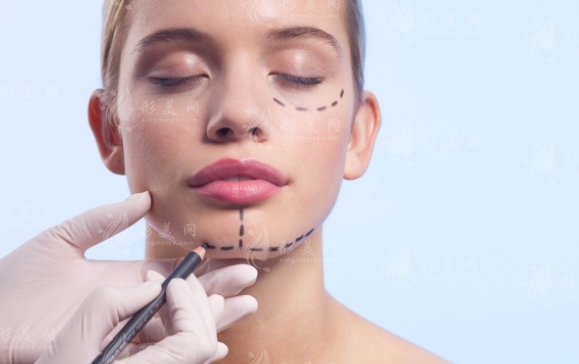 玻尿酸豐面頰：劑量與效果解析