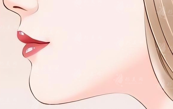 下頜角切除手術(shù)的價(jià)格與優(yōu)勢(shì)