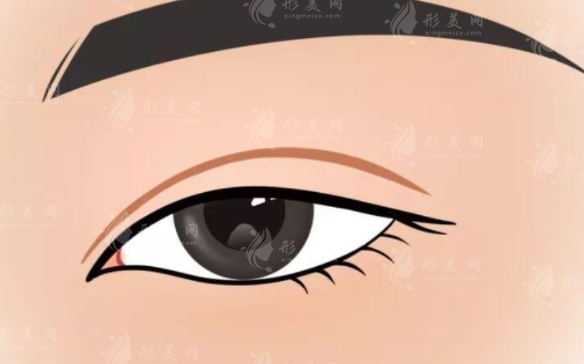 北京八大處雙眼皮修復(fù)價(jià)格一般多少錢(qián)？費(fèi)用常見(jiàn)問(wèn)題你問(wèn)我答