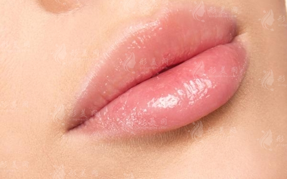 嘴唇外翻矯正多少錢？唇外翻矯正后如何避免后遺癥？
