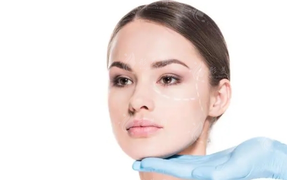 隆額頭手術(shù)的后遺癥與風(fēng)險(xiǎn)分析