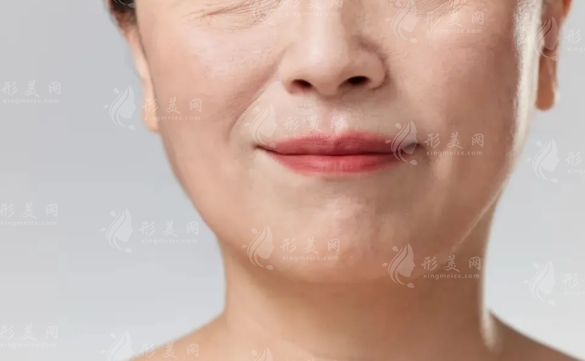 埋線除皺后多久能洗臉及其優(yōu)點(diǎn)解析 埋線除皺后多久能洗臉及其優(yōu)點(diǎn)解析