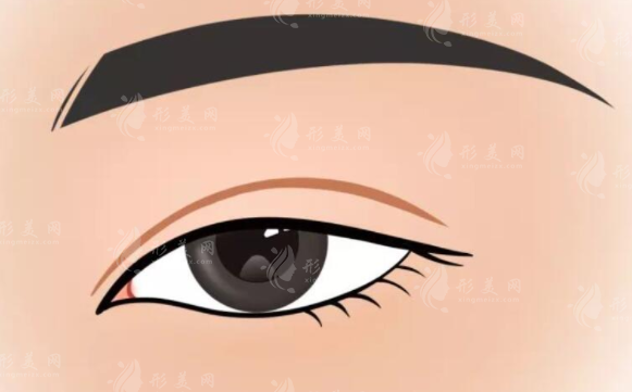 上海時光整形雙眼皮怎么樣？醫(yī)生名單揭曉、案例分享、收費表