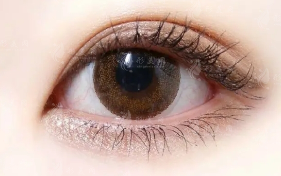 三點(diǎn)與埋線雙眼皮信息介紹及選擇指南