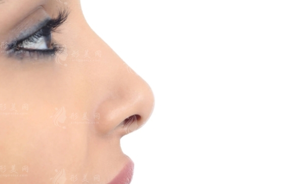 鼻翼內(nèi)切的原理及其與外切的比較