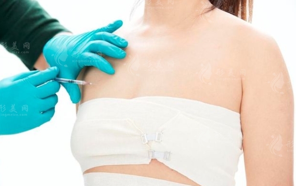 自體脂肪隆胸二次手術(shù)費用及影響因素