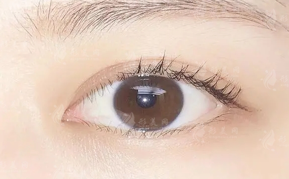 什么眼型適合內(nèi)眼角，什么眼型適合開(kāi)外眼角