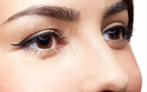 內(nèi)切眼袋會影響視力嗎？恢復需要多長時間？