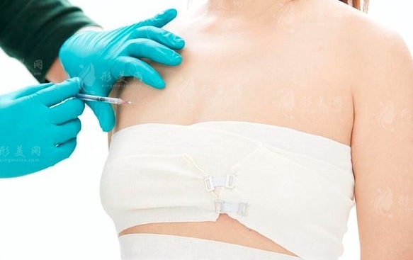 吸脂豐胸的特點(diǎn)與適用癥狀